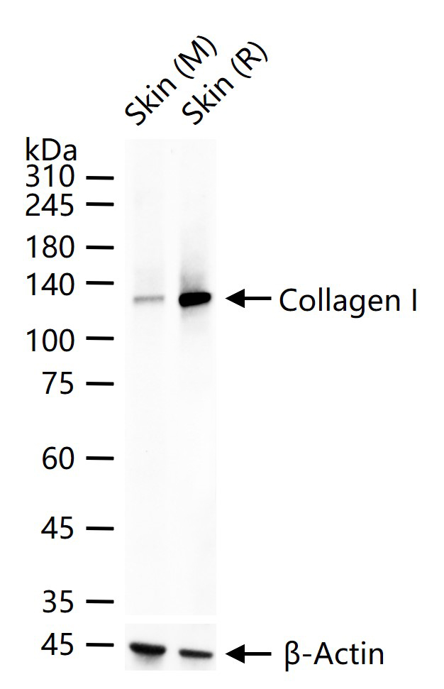 1 - Collagen I Rabbit pAb AP94077