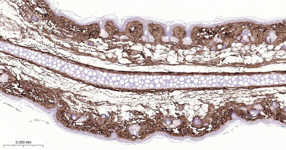 14 - Collagen I Rabbit pAb AP94077