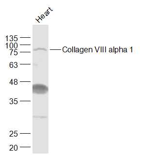 1 - Collagen VIII alpha 1 Rabbit pAb AP94078