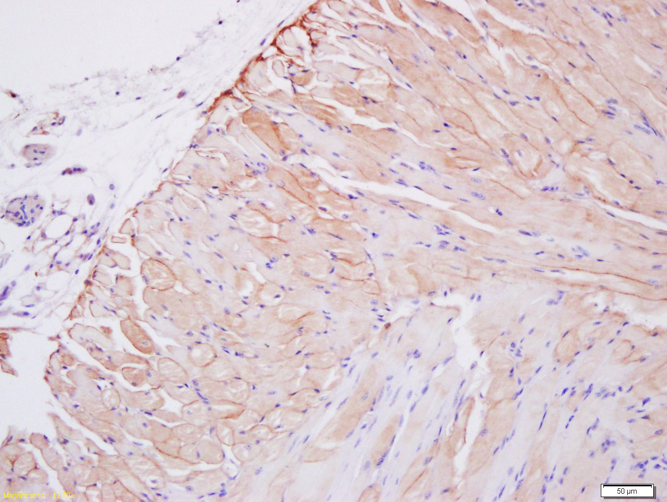 14 - Collagen VIII alpha 1 Rabbit pAb AP94078