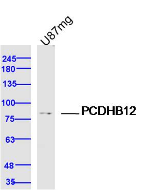 1 - PCDHB12 Rabbit pAb AP94079