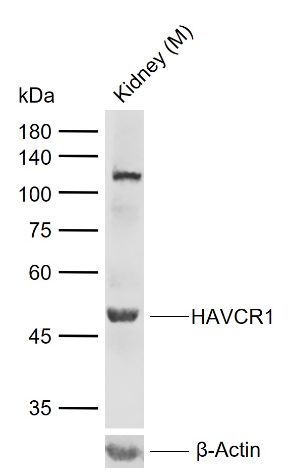 1 - HAVCR1 Rabbit pAb AP94080