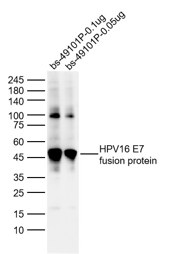 1 - HPV16 E7 Rabbit pAb AP94081
