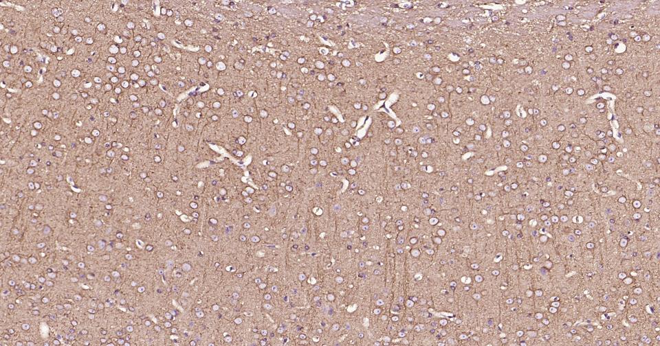 14 - Beta tubulin Mouse mAb AP94082