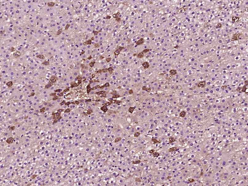 14 - Phosphotyrosine Mouse mAb AP94083
