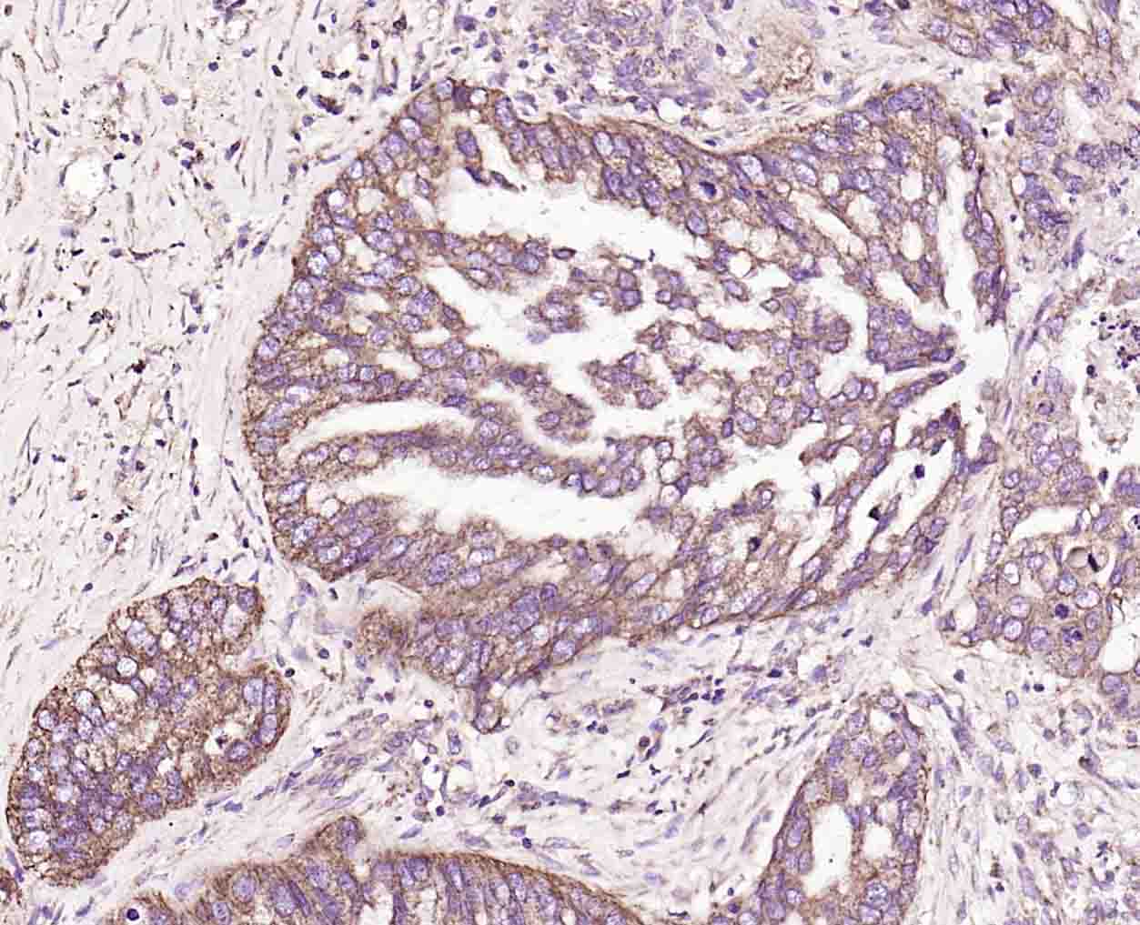 14 - CD48 Rabbit pAb AP94088