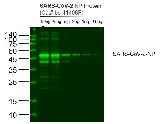 1 - SARS-CoV-2 (2019-nCoV) Nucleocapsid Mouse mAb AP94092