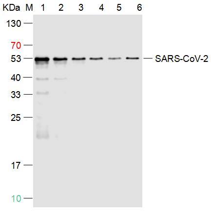 1 - SARS-CoV-2 (2019-nCoV) Nucleocapsid Mouse mAb AP94093