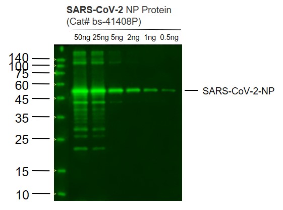 1 - SARS-CoV-2 (2019-nCoV) Nucleocapsid Mouse mAb AP94094