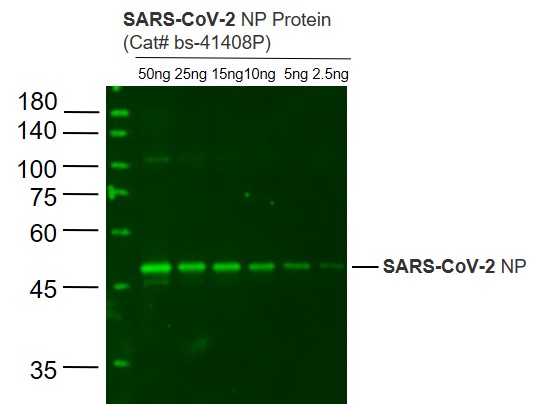 1 - SARS-CoV-2 N protein Rabbit pAb AP94095