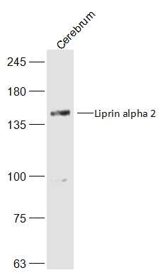 1 - Liprin alpha 2 Rabbit pAb AP94099
