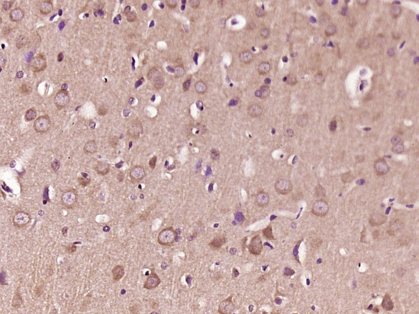 14 - Liprin alpha 2 Rabbit pAb AP94099
