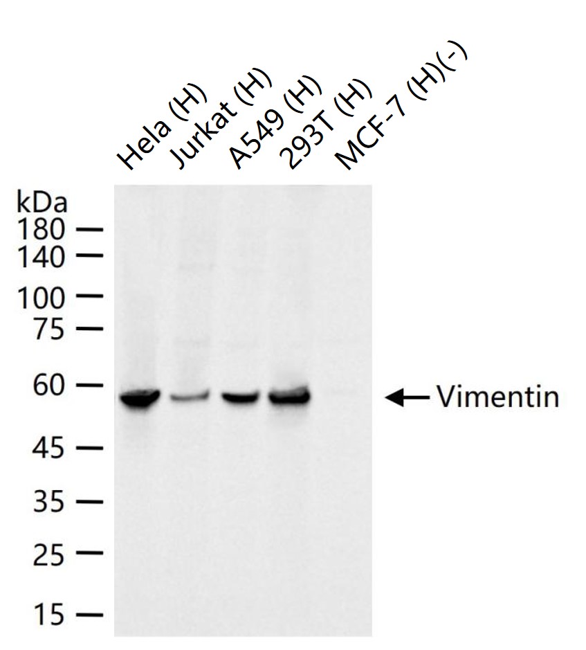 1 - EMT Research Antibody Assembly kit (E-Cadherin,N-Cadherin,Vimentin,Occludin,ZO-1) AP94100