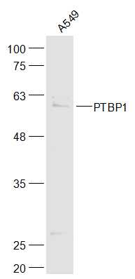 1 - PTBP1 Rabbit pAb AP94102