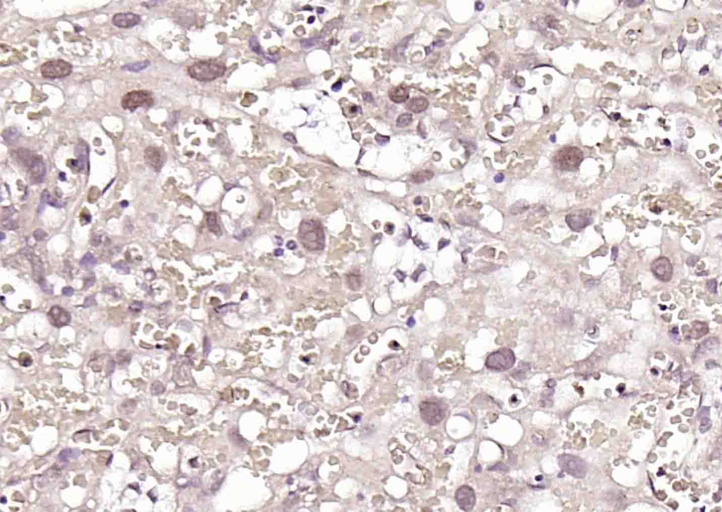 14 - PTBP1 Rabbit pAb AP94102