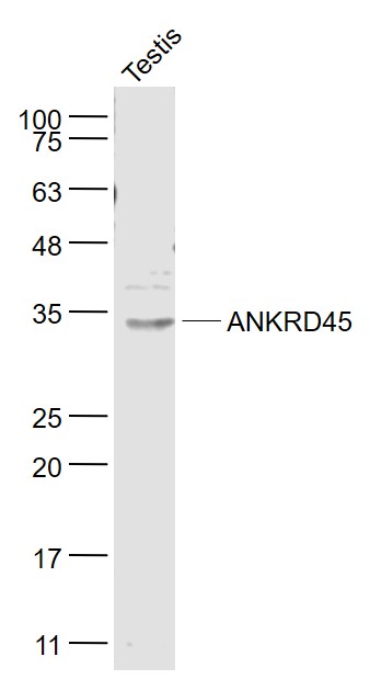 1 - ANKRD45 Rabbit pAb AP94104