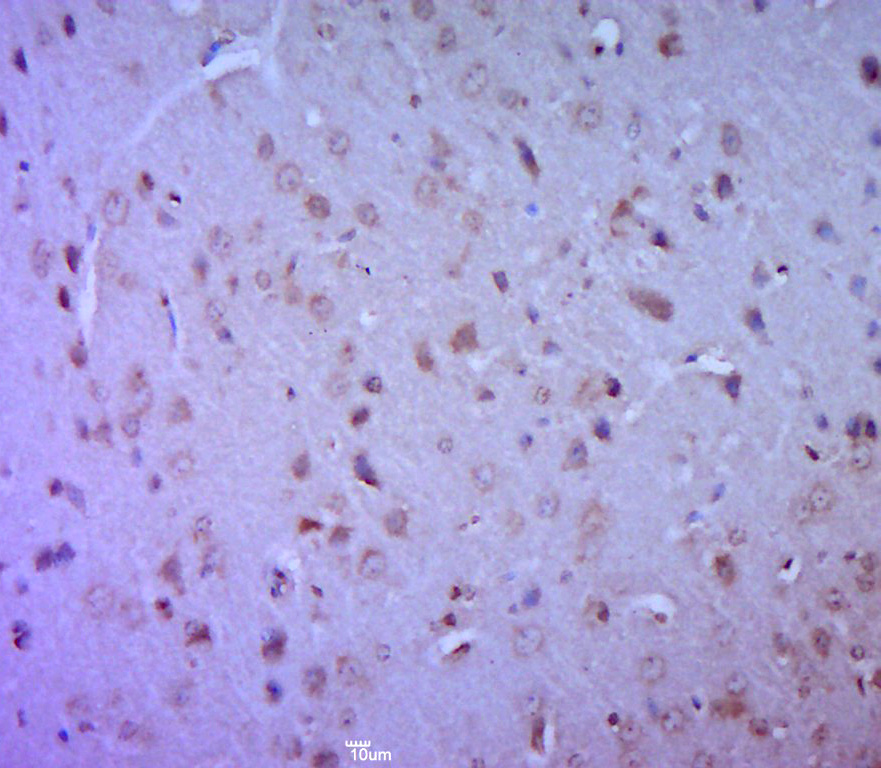 14 - LAMC1 Rabbit pAb AP94107