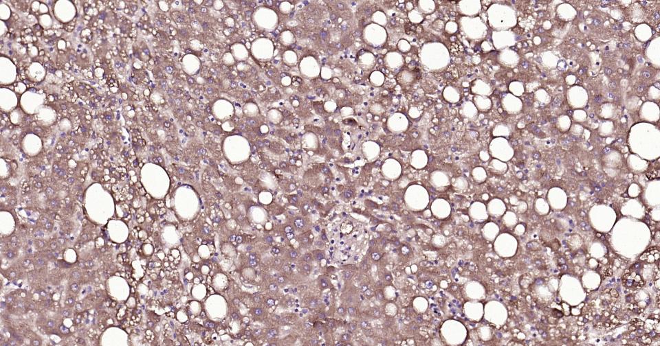 14 - ox-LDL Mouse mAb AP94108