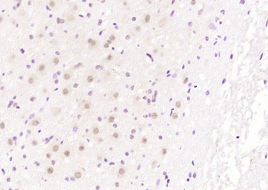14 - NUSAP1 Rabbit pAb AP94110