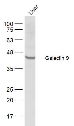 1 - Galectin 9 Rabbit pAb AP94113
