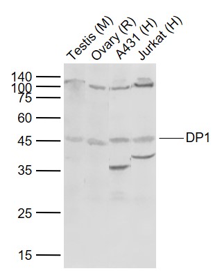 1 - DP1 Rabbit pAb AP94114