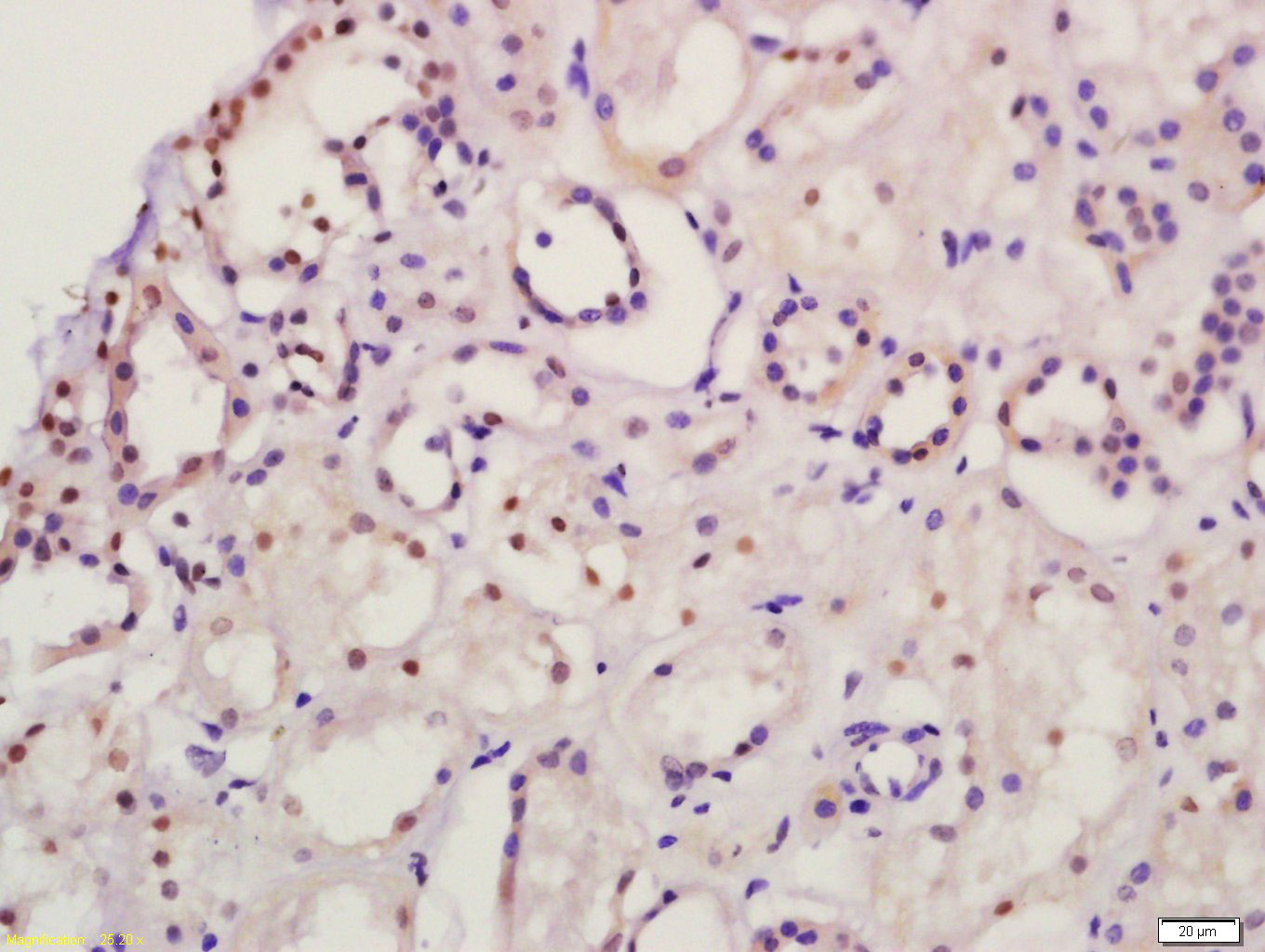 14 - DP1 Rabbit pAb AP94114