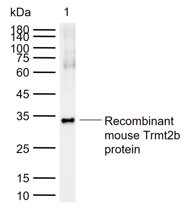 1 - TRMT2B Rabbit pAb AP94115