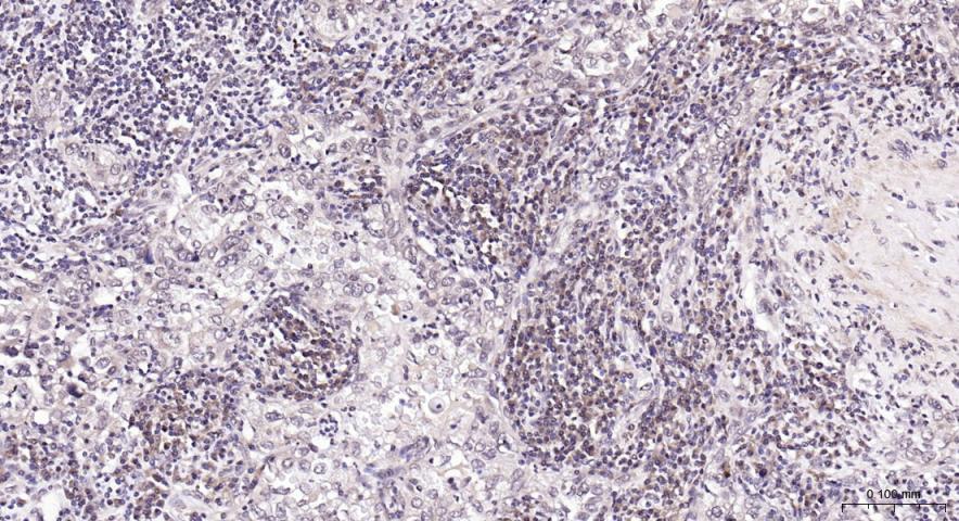 14 - PI3 Kinase p110 beta Rabbit pAb AP94117