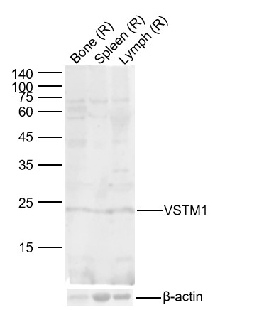 1 - VSTM1 Rabbit pAb AP94122