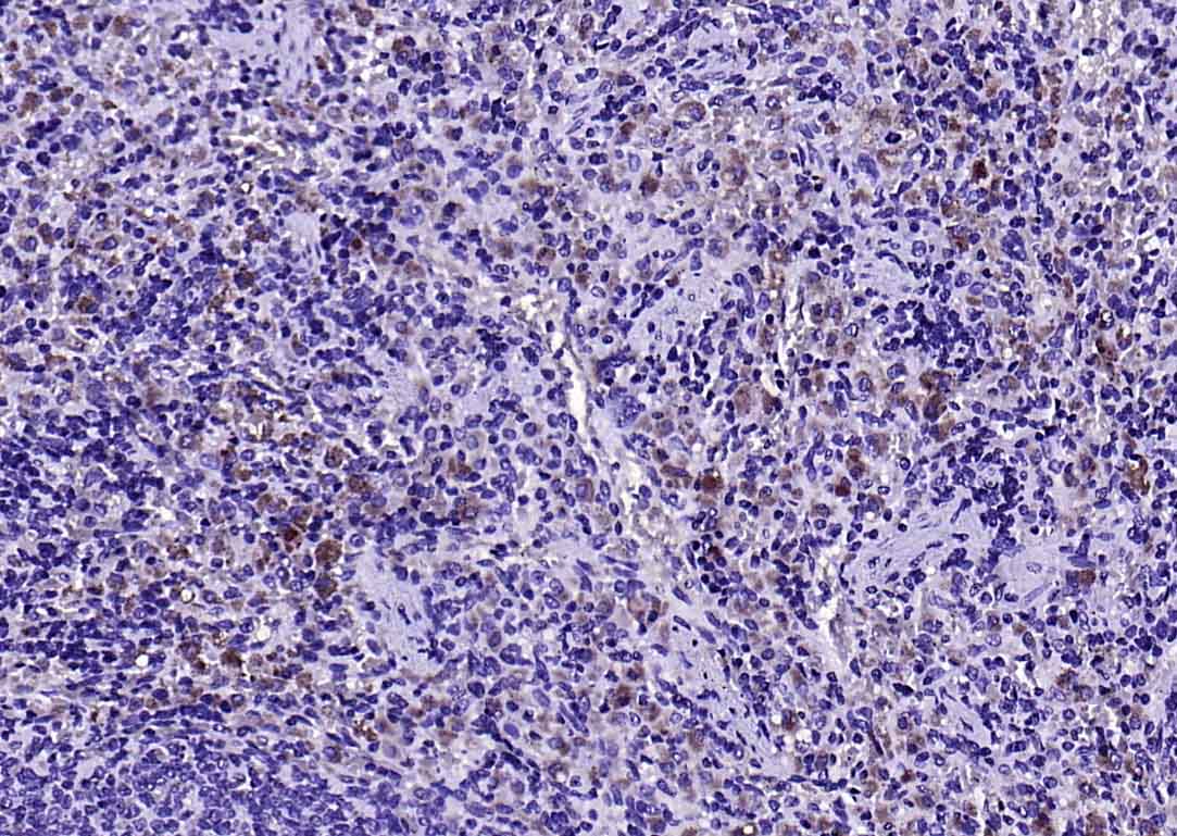 14 - VSTM1 Rabbit pAb AP94122