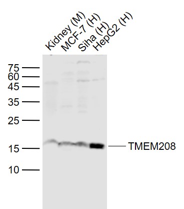 1 - TMEM208 Rabbit pAb AP94124