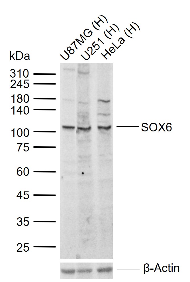 1 - SOX6 Rabbit pAb AP94126
