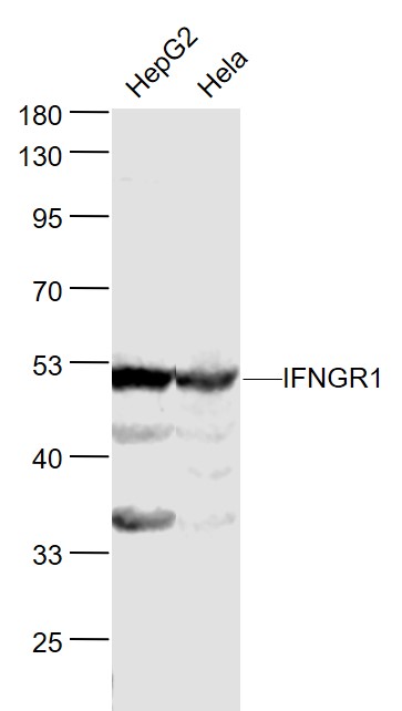 1 - IFNGR1 Rabbit pAb AP94130