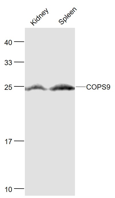 1 - COPS9 Rabbit pAb AP94131