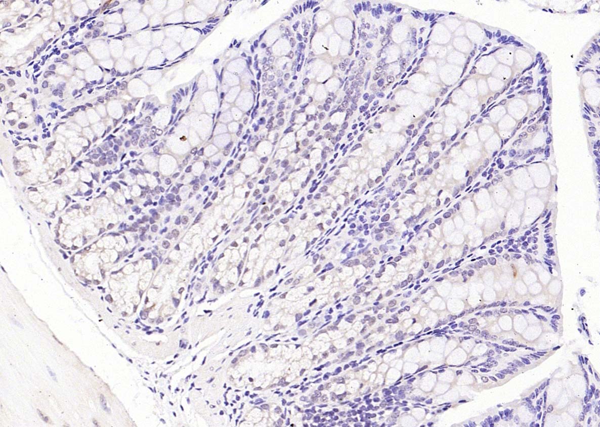14 - phospho-PI3 Kinase p110 beta (Ser1070) Rabbit pAb AP94133