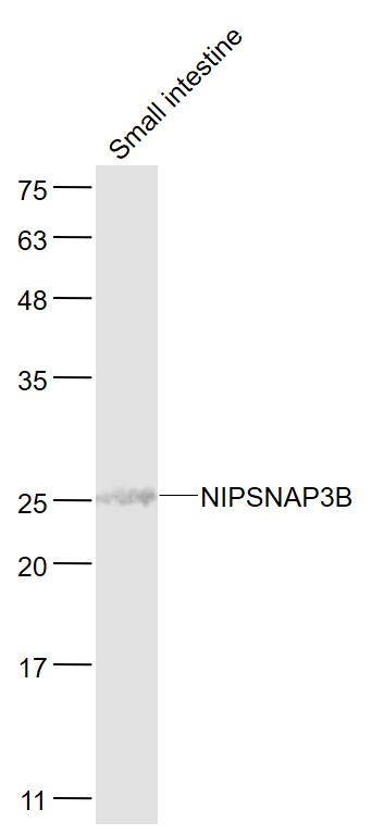 1 - NIPSNAP3B Rabbit pAb AP94134