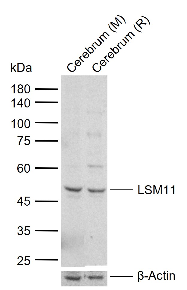 1 - LSM11 Rabbit pAb AP94139