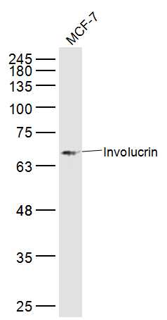 1 - Involucrin Rabbit pAb AP94141