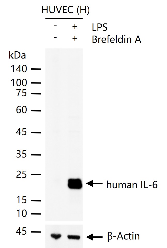 1 - Human IL-6 Mouse mAb AP94142
