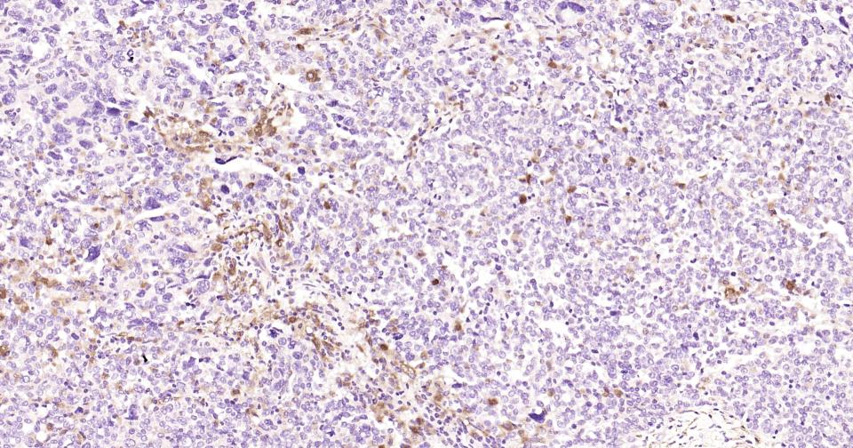 14 - Human IL-6 Mouse mAb AP94142