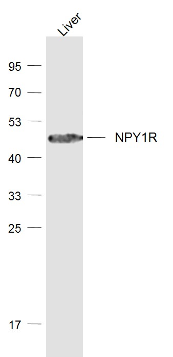 1 - NPY1R Rabbit pAb AP94143