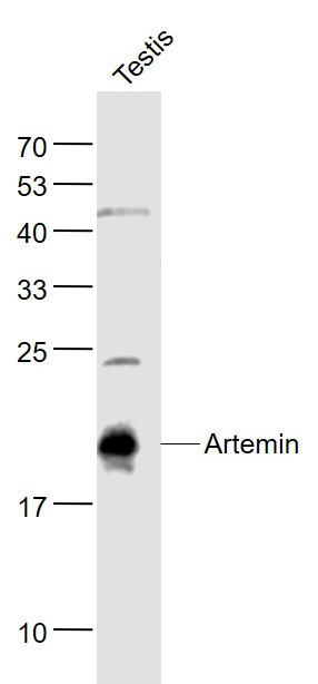 1 - Artemin Rabbit pAb AP94144