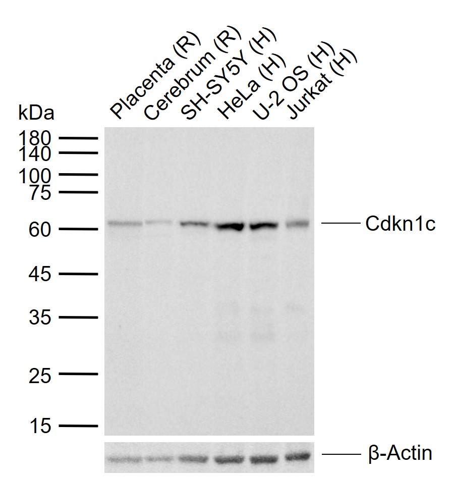 1 - Cdkn1c Rabbit pAb AP94146