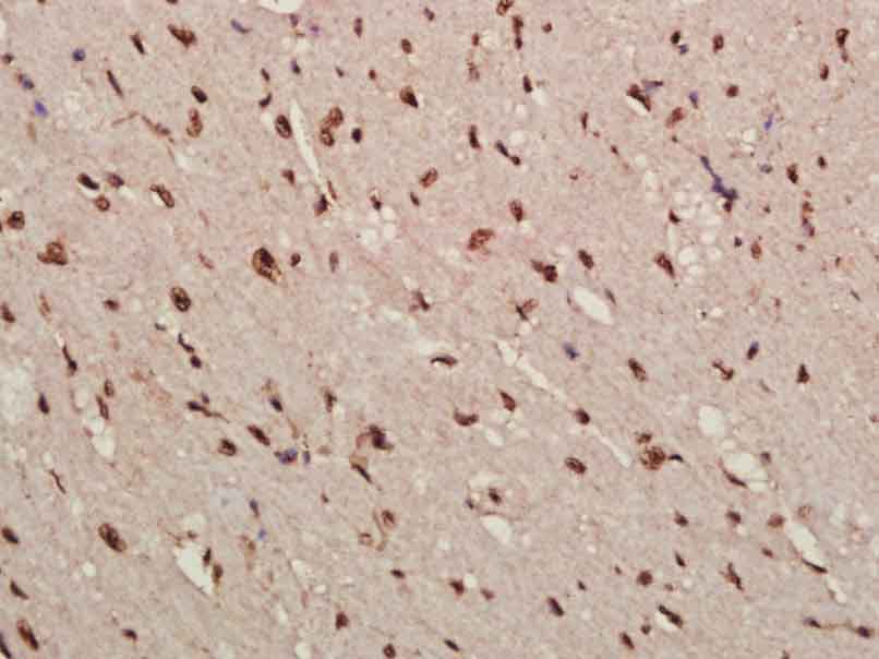 14 - Cdkn1c Rabbit pAb AP94146