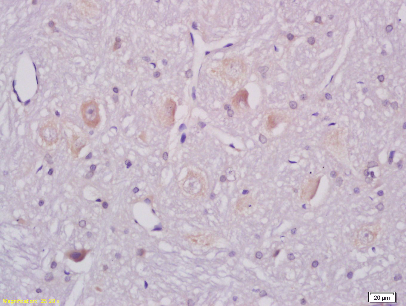 14 - ganglioside GM1 Rabbit pAb AP94147