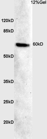 1 - CDKAL1 Rabbit pAb AP94154