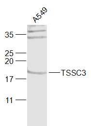 1 - TSSC3 Rabbit pAb AP94156