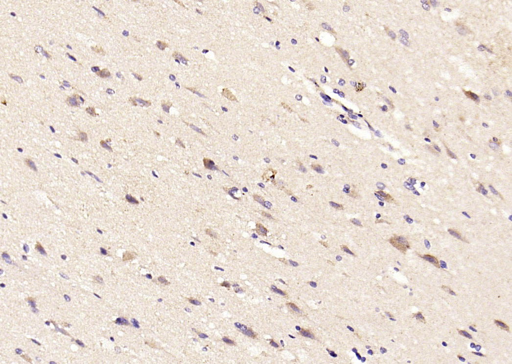 14 - TSSC3 Rabbit pAb AP94156