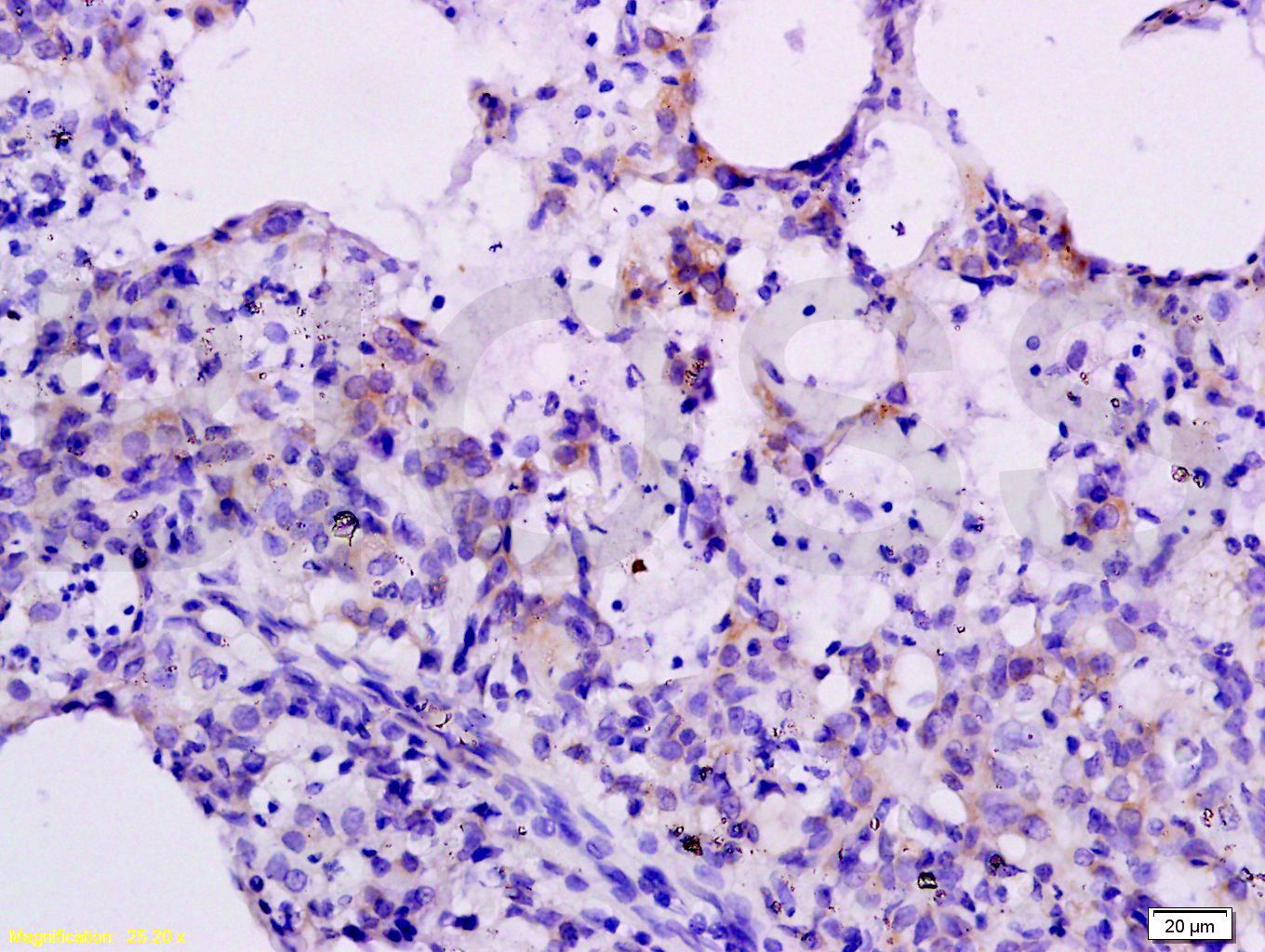 14 - CXCL10/IP10 Rabbit pAb AP94159