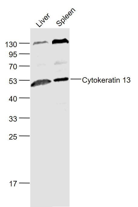1 - Cytokeratin 13 Rabbit pAb AP94161